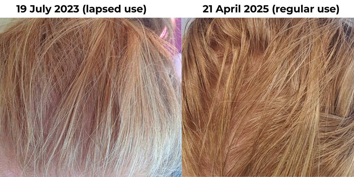 GreyAway Red Hair (1) hair strengthening serum